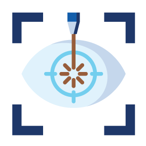 An illustration depicting eye surgery